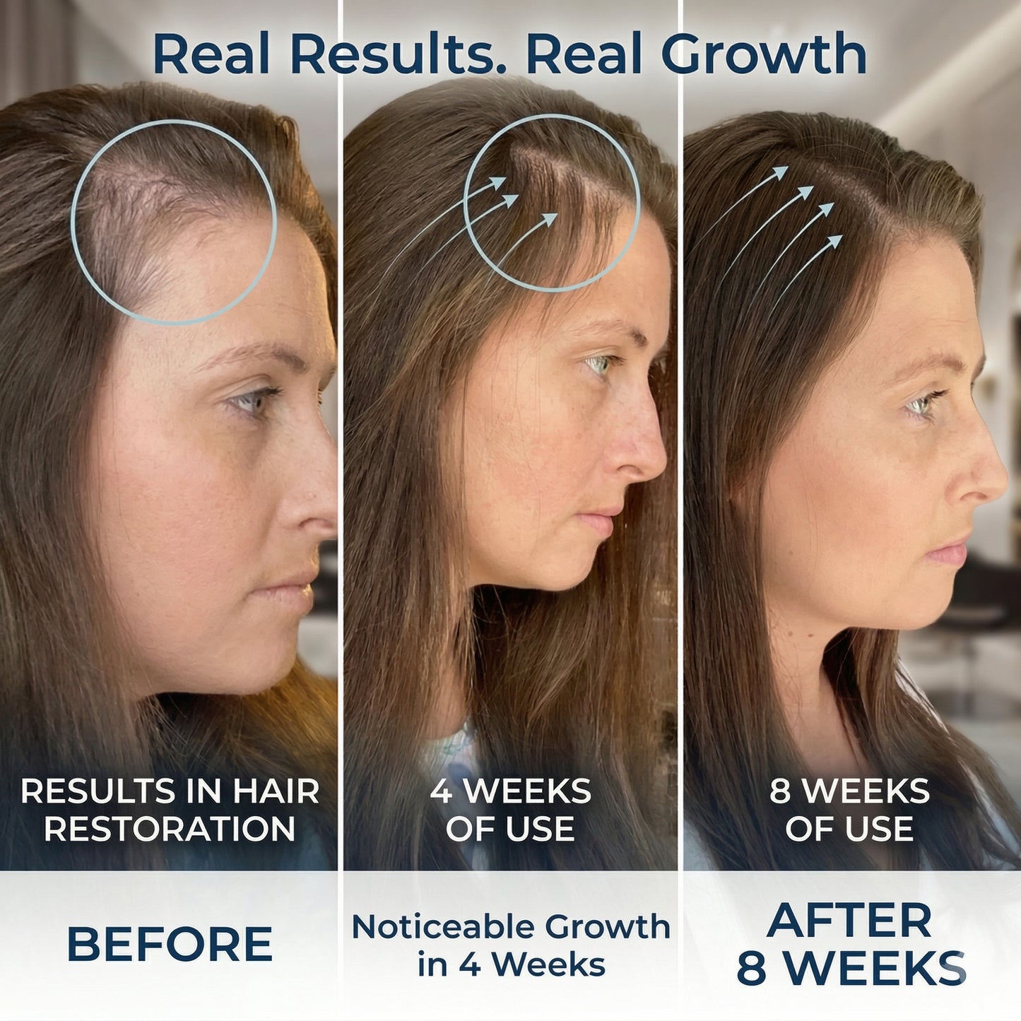 ManeBloom™ Rosemary Hair Growth