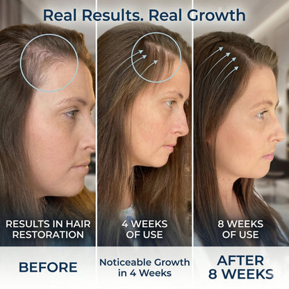 ManeBloom™ Rosemary Hair Growth